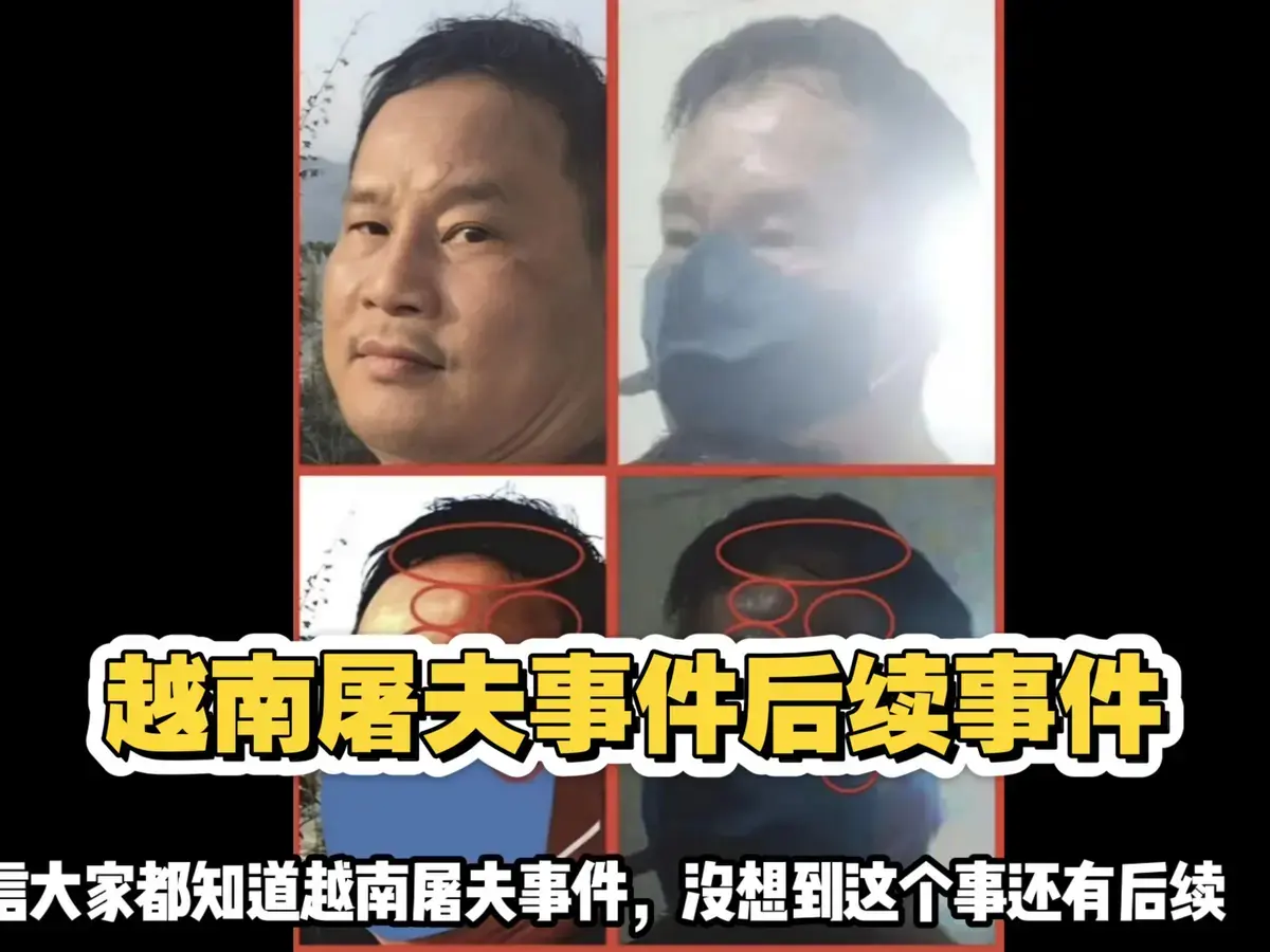 《越南屠夫阮春达案》无广告在线播放 - 神级操作解剖现场实录 - 越南屠夫极限猎杀HD